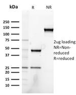 Heregulin-1/Neuregulin-1 Antibody in SDS-PAGE (SDS-PAGE)