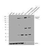 Human IgG F(ab')2 Cross-Adsorbed Secondary Antibody in Western Blot (WB)