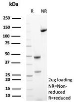 HLA-G (Major Histocompatibility Complex, class I, G) Antibody in SDS-PAGE (SDS-PAGE)