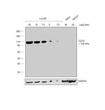 Goat IgG (H+L) Secondary Antibody in Western Blot (WB)