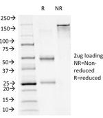 FOXA1/HNF3A Antibody in SDS-PAGE (SDS-PAGE)