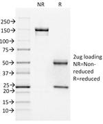 FOXA1/HNF3A Antibody in SDS-PAGE (SDS-PAGE)
