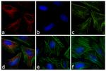 Rabbit IgG (H+L) Cross-Adsorbed Secondary Antibody in Immunocytochemistry (ICC/IF)