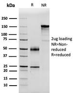 Serum Amyloid P/APCS Antibody in SDS-PAGE (SDS-PAGE)