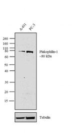 PKP1 Antibody in Western Blot (WB)