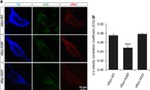 alpha Synuclein Antibody in Immunocytochemistry (ICC/IF)