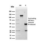 HSP60 (Heat Shock Protein 60) (Mitochondrial Marker) Antibody in SDS-PAGE (SDS-PAGE)