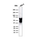 HSP60 (Heat Shock Protein 60) (Mitochondrial Marker) Antibody in Western Blot (WB)