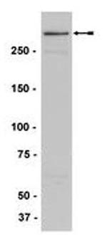 MLL Antibody in Western Blot (WB)