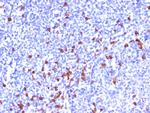 IgG (Immunoglobulin Gamma Heavy Chain) (B Cell Marker) Antibody in Immunohistochemistry (Paraffin) (IHC (P))