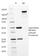 IgM (Immunoglobulin Mu Heavy Chain) (B-Cell Marker) Antibody in SDS-PAGE (SDS-PAGE)