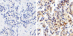 MMP2 Antibody in Immunohistochemistry (Paraffin) (IHC (P))