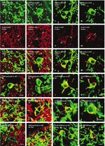 Connexin 43 Antibody in Immunohistochemistry (IHC)