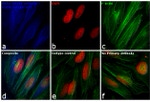 Rabbit IgG (H+L) Cross-Adsorbed Secondary Antibody in Immunocytochemistry (ICC/IF)