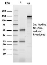 CD25/IL2RA (Activated Lymphocyte Marker) Antibody in SDS-PAGE (SDS-PAGE)