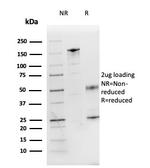 Interleukin-3 (IL-3) Antibody in Immunoelectrophoresis (IE)