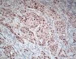 Phospho-ERK1/ERK2 (Thr202, Tyr204) Antibody in Immunohistochemistry (Paraffin) (IHC (P))