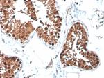 Inhibin, alpha (INHA) (Gonadal Cell Marker) Antibody in Immunohistochemistry (Paraffin) (IHC (P))