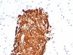 Inhibin, alpha (INHA) (Gonadal Cell Marker) Antibody in Immunohistochemistry (Paraffin) (IHC (P))