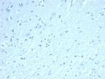 Inhibin, alpha (INHA) (Gonadal Cell Marker) Antibody in Immunohistochemistry (Paraffin) (IHC (P))