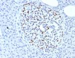 INSM1 (Pan-Neuroendocrine Marker) Antibody in Immunohistochemistry (Paraffin) (IHC (P))