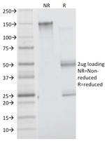 Insulin Receptor Alpha Antibody in SDS-PAGE (SDS-PAGE)