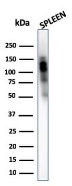 CD11b/MAC-1 Antibody in Western Blot (WB)