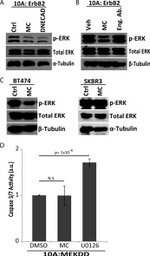 Phospho-ERK1/ERK2 (Thr202, Tyr204) Antibody in Western Blot (WB)