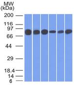 Catenin, gamma (Cardiomyocyte Marker) Antibody in Western Blot (WB)