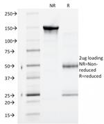 Catenin, gamma Antibody in SDS-PAGE (SDS-PAGE)