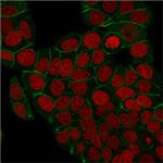 Catenin, gamma (Cardiomyocyte Marker) Antibody in Immunocytochemistry (ICC/IF)