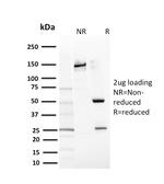 CD117/c-Kit (Marker for Gastrointestinal Stromal Tumors) Antibody in SDS-PAGE (SDS-PAGE)