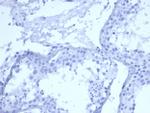 Cytokeratin 5 (KRT5) Antibody in Immunohistochemistry (Paraffin) (IHC (P))