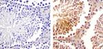 SOCS1 Antibody in Immunohistochemistry (Paraffin) (IHC (P))