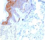 Cytokeratin 6/KRT6 (Pan; a,b,c) (Basal Cell Marker) Antibody in Immunohistochemistry (Paraffin) (IHC (P))