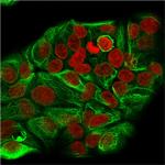 Cytokeratin 15 (Esophageal Squamous Cell Carcinoma Marker) Antibody in Immunocytochemistry (ICC/IF)