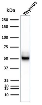 Cytokeratin 15 (Esophageal Squamous Cell Carcinoma Marker) Antibody in Western Blot (WB)