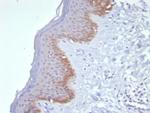 Cytokeratin 15 (Esophageal Squamous Cell Carcinoma Marker) Antibody in Immunohistochemistry (Paraffin) (IHC (P))