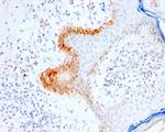 Cytokeratin 15 (Esophageal Squamous Cell Carcinoma Marker) Antibody in Immunohistochemistry (Paraffin) (IHC (P))