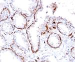 Cytokeratin 15 (Esophageal Squamous Cell Carcinoma Marker) Antibody in Immunohistochemistry (Paraffin) (IHC (P))