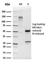 Cytokeratin 19 (KRT19) Antibody in SDS-PAGE (SDS-PAGE)