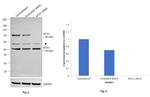 MTA1 Antibody in Western Blot (WB)