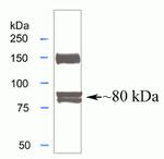 MTA1 Antibody in Western Blot (WB)