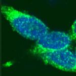 Rad51 Antibody in Immunocytochemistry (ICC/IF)