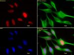 HDAC2 Antibody in Immunocytochemistry (ICC/IF)