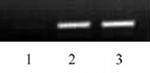 Histone H3K79ac Antibody in ChIP Assay (ChIP)