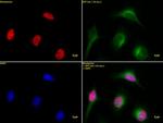 Histone H3K9ac Antibody in Immunocytochemistry (ICC/IF)