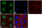 FAK Antibody in Immunocytochemistry (ICC/IF)