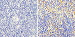 FAK Antibody in Immunohistochemistry (Paraffin) (IHC (P))