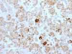 LH-beta (Luteinizing Hormone-beta) Antibody in Immunohistochemistry (Paraffin) (IHC (P))